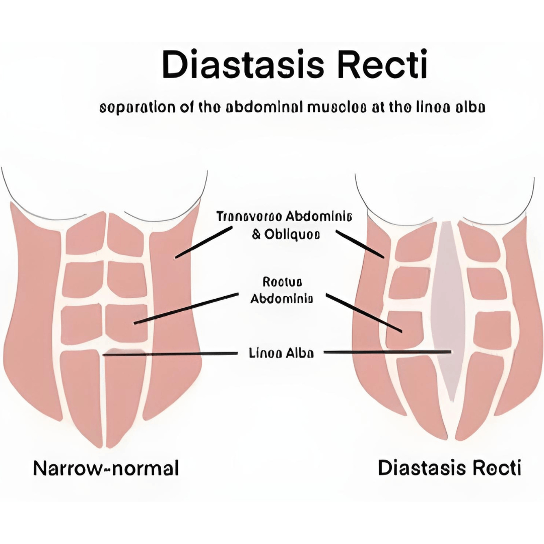 Pelvic Floor Strong How helps me